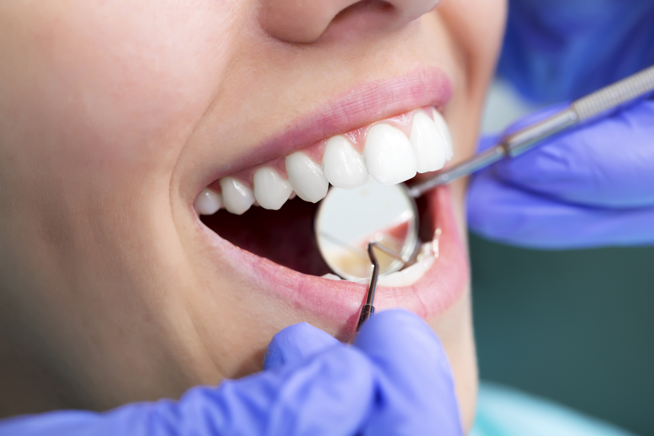 5 bonnes raisons de visiter son dentiste régulièrement